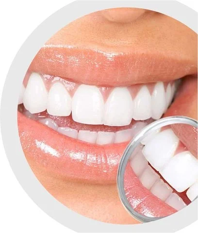 teeth cleaning in noida
