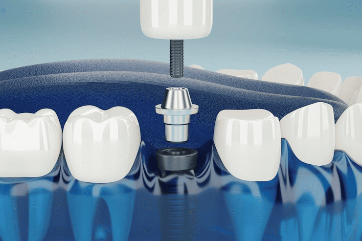 Smiles That Stay: Modern Dental Care Shaping Noida’s Confidence