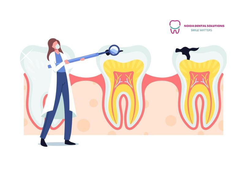 Say Goodbye to Tooth Pain and Crooked Teeth: Root Canal and Teeth Aligners Made Simple
