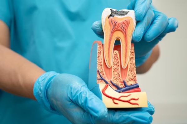 Signs You May Need a Root Canal: Symptoms Not to be Ignored