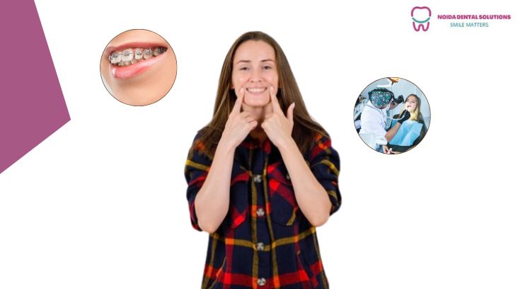 Teeth Aligners Treatment In Noida: Why Age 20 Can Be a Great Time