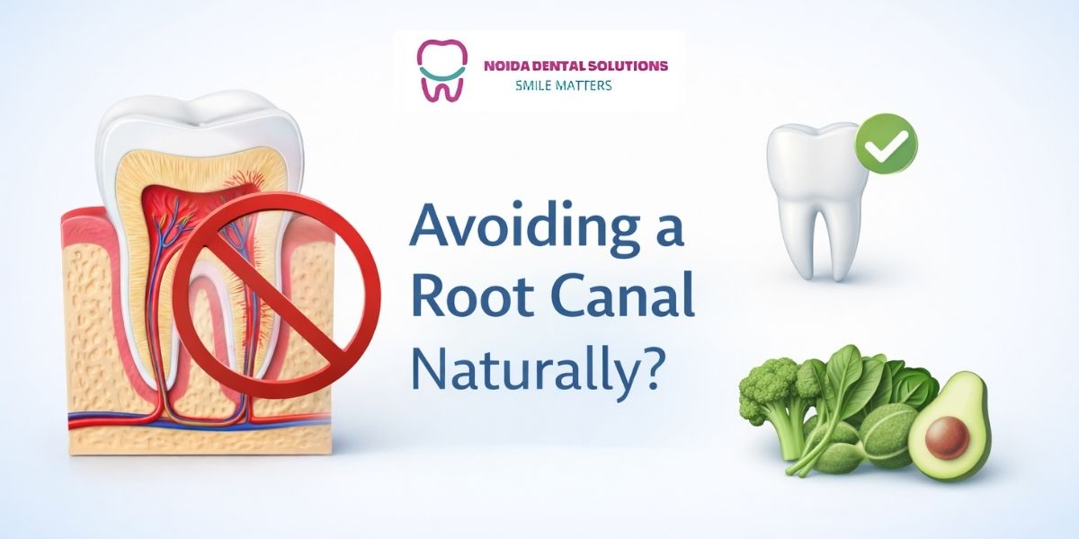 How Can I Avoid a Root Canal Naturally?