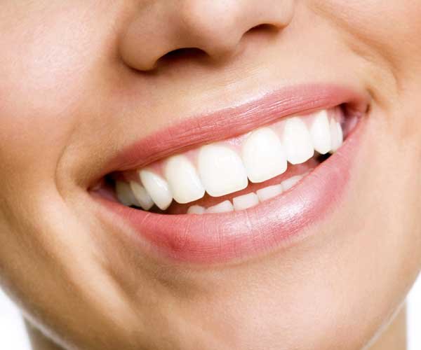 teeth whitening in noida