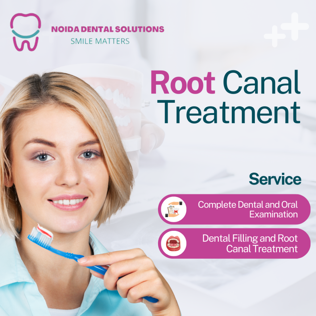 root canal treatment in Noida